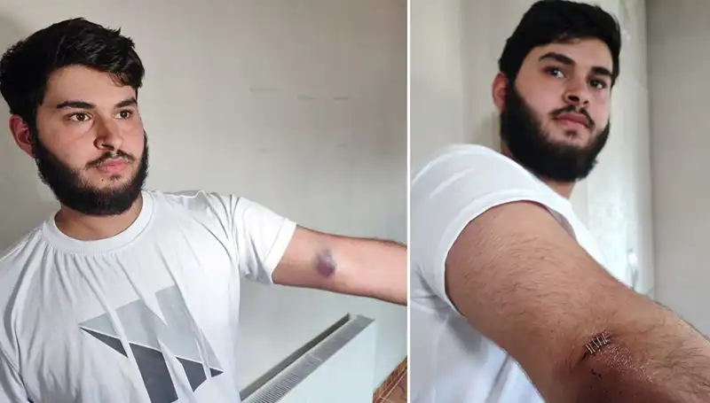 Bahçeye Kaçan Top, Mahalleyi Karıştırdı: "Conolar Kamyonetle Geldi"